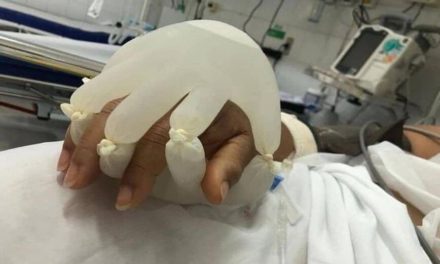 Τα γάντια με ζεστό νερό σε ασθενείς με κορονοϊό για να μη νιώθουν μόνοι